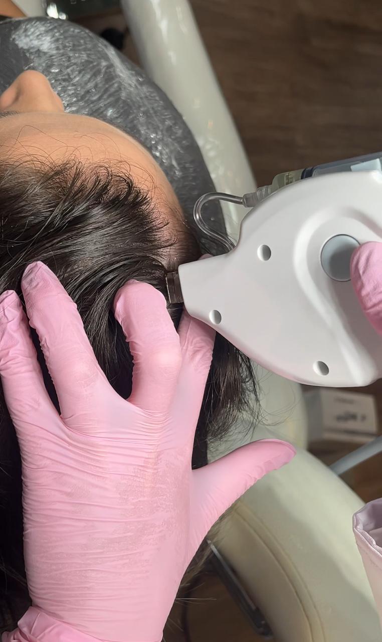 Novo resultado de tratamento 1