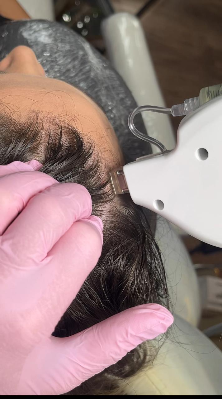 Novo resultado de tratamento 2