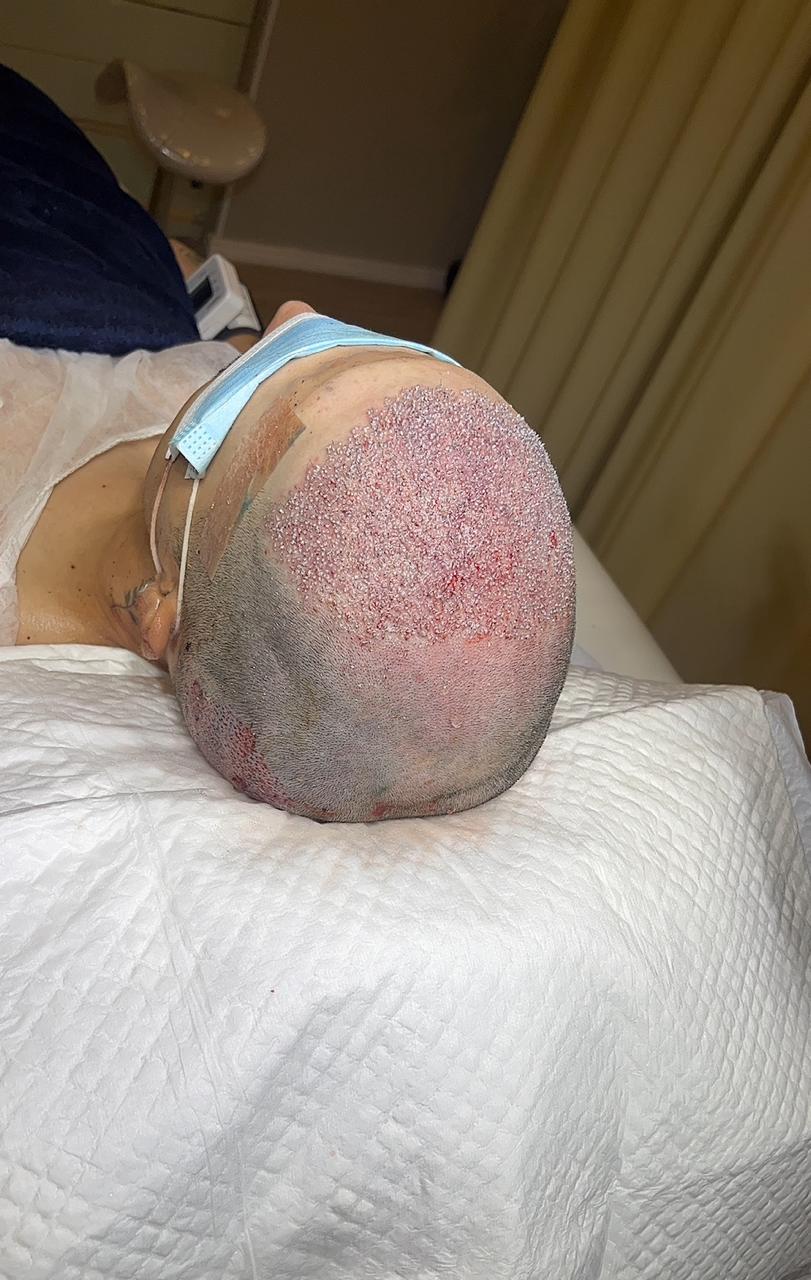 Resultado de tratamento capilar 2