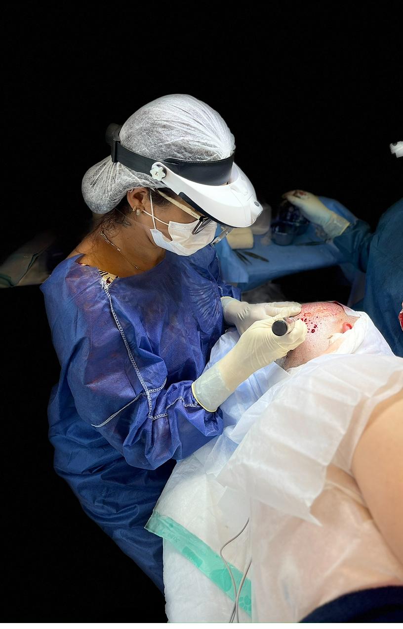 Resultado de tratamento capilar 1